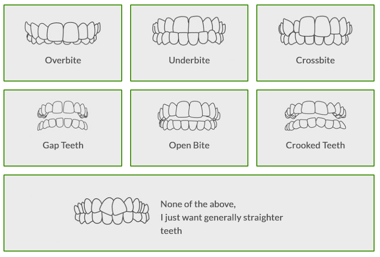 Invisalign | Dr. Edward C. Yates