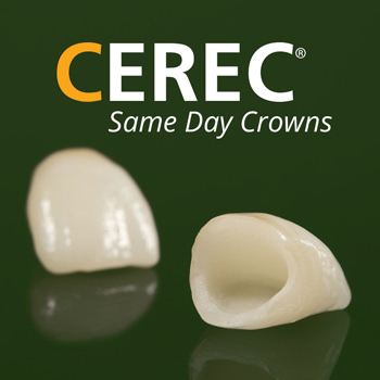 CEREC - Same Day Crowns